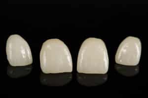 dental crowns of different sizes