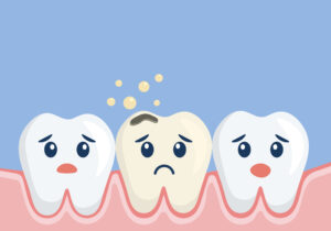 Maple Grove, MN, dentist offers dental fillings 