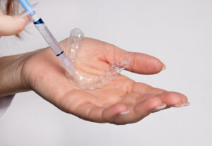 maple grove teeth whitening