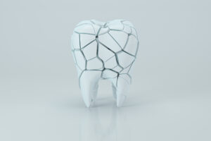 maple grove bonding and contouring